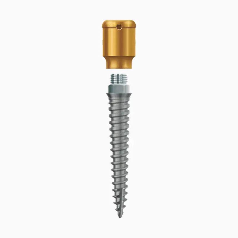 Lodi 2.4×12 Mm Cuff – 4.0 Mm Height 1